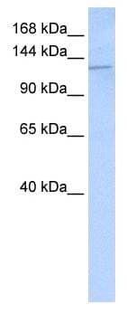 Polyclonal Rabbit anti-Human DSG2 / Desmoglein 2 Antibody (aa72-121, IHC, WB)