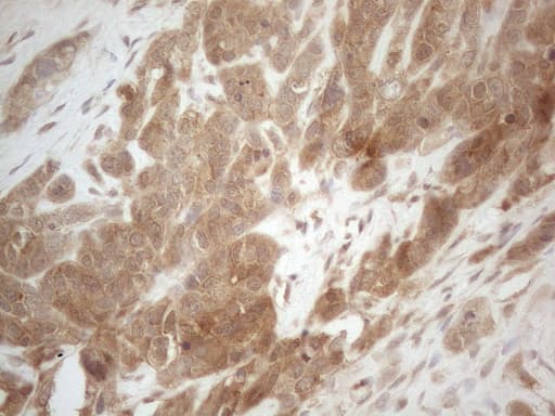 Monoclonal Mouse anti-Human PPP1CA / PP1-Alpha Antibody (clone OTI6E5, Carrier-free, IHC, WB)