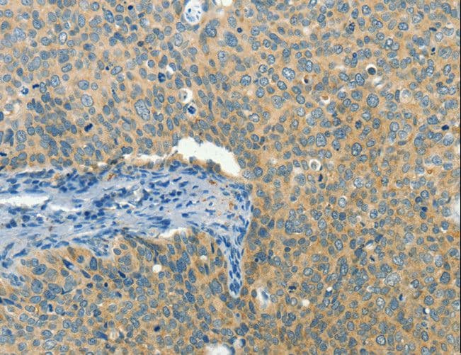 IHC-plus™ Polyclonal Rabbit anti-Human BCAT1 / ECA39 Antibody (IHC)