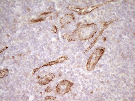 PROCR / EPCR Antibody (aa1-210, clone UMAB200)