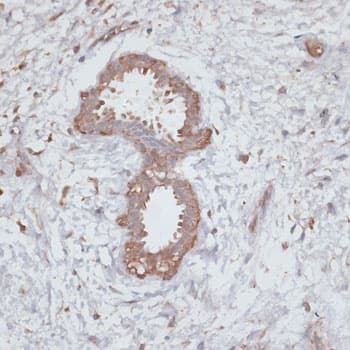 TGFBR2 Antibody