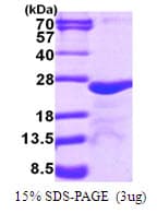 Human MFSD7 / MYL5 Protein (Recombinant His)