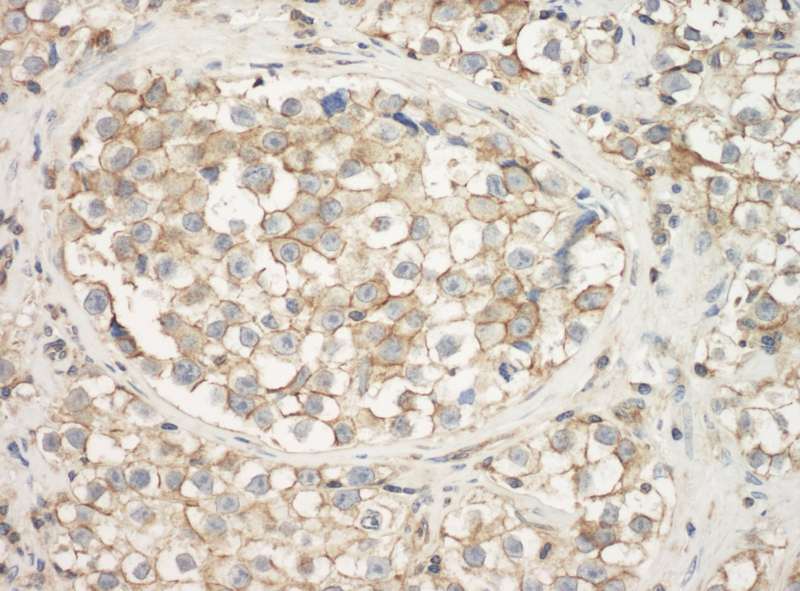 Polyclonal Rabbit anti-Human ACTG1 / Gamma Actin Antibody (N-Terminus, IHC, WB)