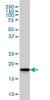 SKP1 Antibody (clone 1H8)