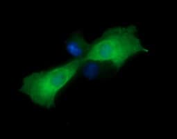 MAP2K1 / MKK1 / MEK1 Antibody (clone OTI1F9)