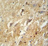 Polyclonal Rabbit anti-Human GABBR2 / GABA B Receptor 2 Antibody (aa861-890, IHC, WB)