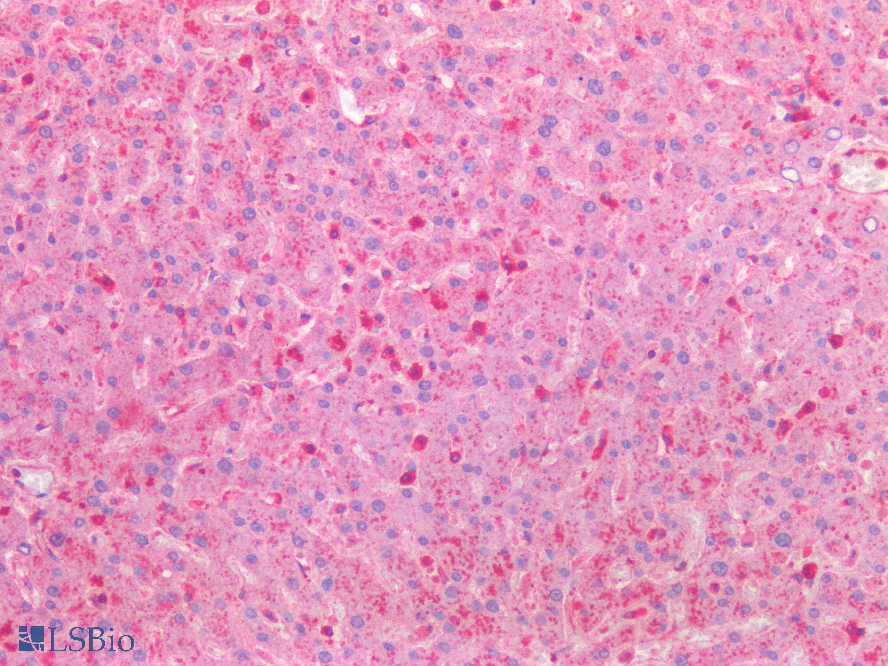 PathPlus™ HEXB Antibody