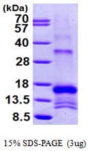 Human SLPI / Antileukoproteinase (Recombinant His)