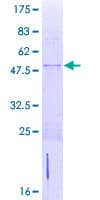 Human ZNF581 Protein (Recombinant GST)