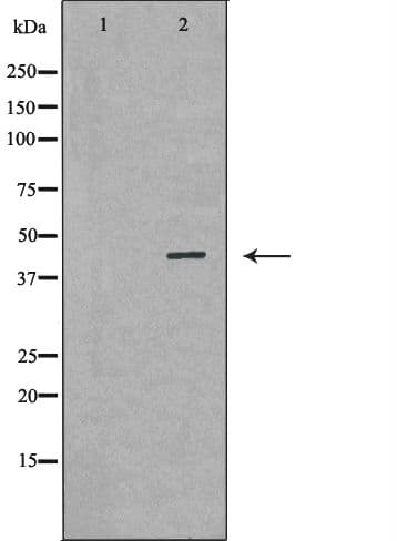 Polyclonal Rabbit anti-Human GLUL / Glutamine Synthetase Antibody (IHC, IF, WB)