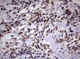 ZEB2 / SIP-1 Antibody (aa1-350, clone OTI1E12)