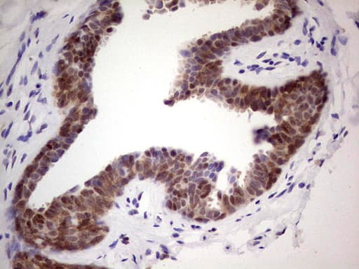 Monoclonal Mouse anti-Human C-TAK1 / MARK3 Antibody (clone OTI3F6, aa473-729, IHC, WB)