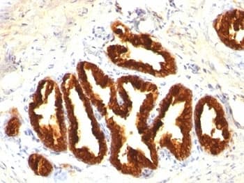 KRT18 / CK18 / Cytokeratin 18 Antibody (clone KRT18 Cocktail)