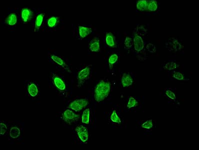 Polyclonal Rabbit anti-Human HIST1H3A Antibody (IF, WB)