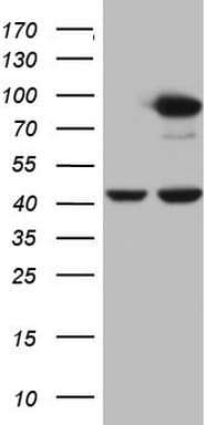 PLOD2 Antibody (aa359-640, clone OTI7G5)