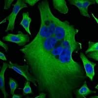 Monoclonal Mouse anti-Human TUBB3 / Tubulin Beta 3 Antibody (IHC, IF, WB)