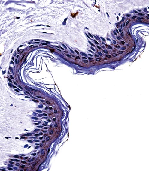 Polyclonal Rabbit anti-Human Tyrosinase Antibody (aa486-513, IHC, IF, WB)