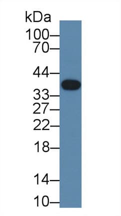 TNNT1 / TNT Antibody (aa1-261)