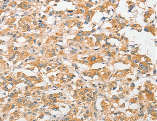 TLR5 Antibody