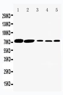 SLC5A1 / SGLT1 Antibody (aa620-635)