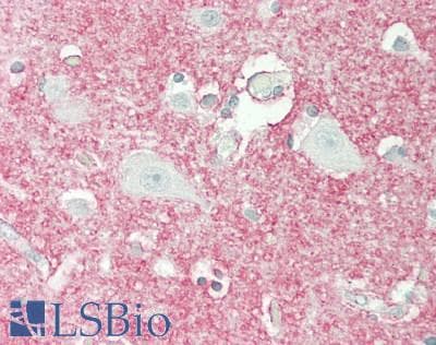 PathPlus™ Polyclonal Rabbit anti-Rat SLC1A3 / EAAT1 Antibody (aa500-542, IHC, WB)