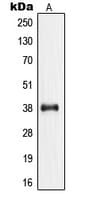 NPM1 / NPM / Nucleophosmin Antibody (phospho-Thr199)