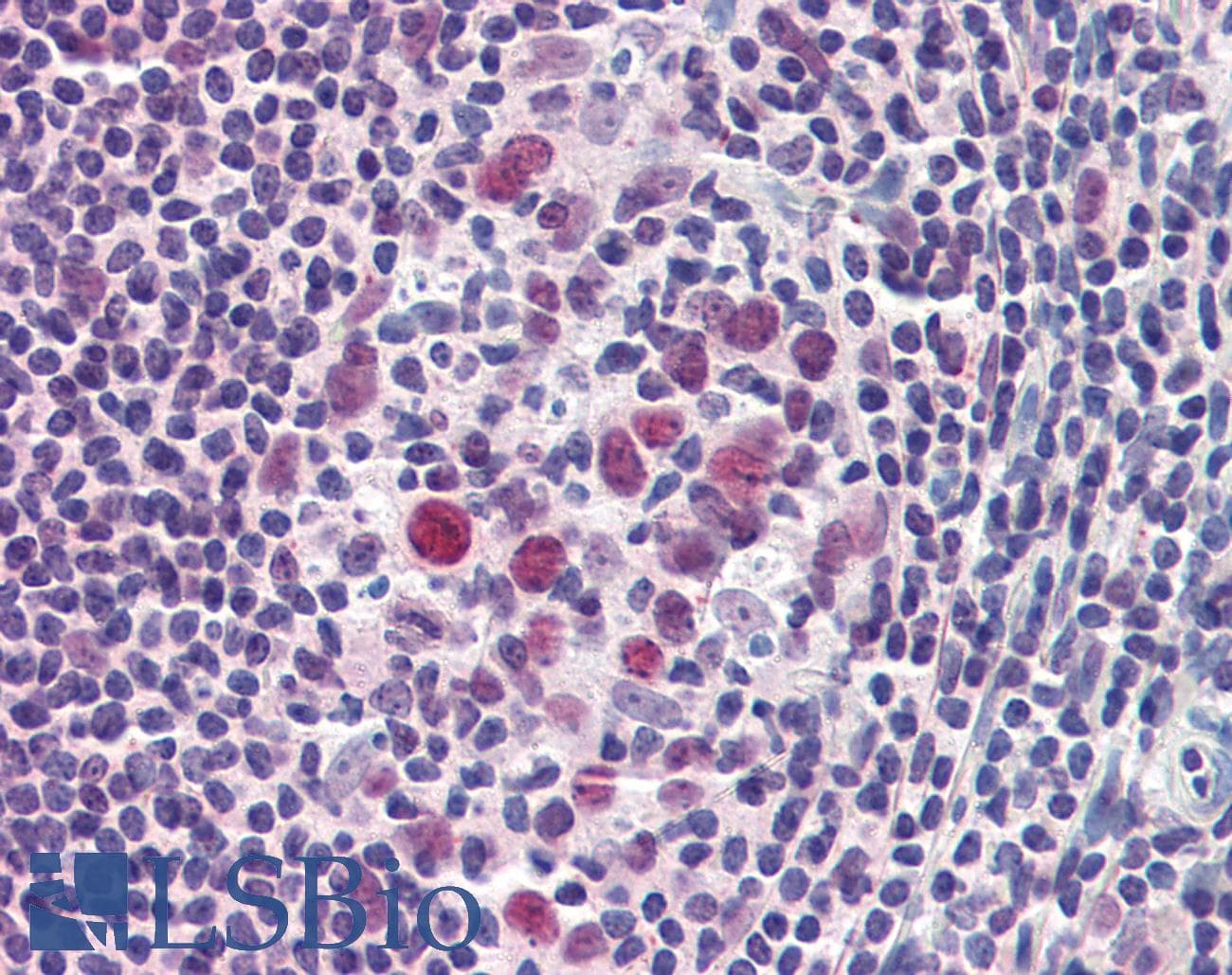 IHC-plus™ AURKB / Aurora-B Antibody (aa1-344)