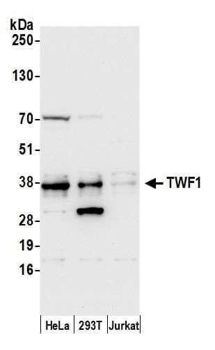 TWF1 / PTK9 Antibody (aa1-50)