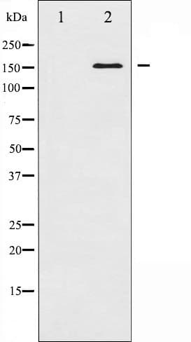 GRIN2B / NMDAR2B / NR2B Antibody