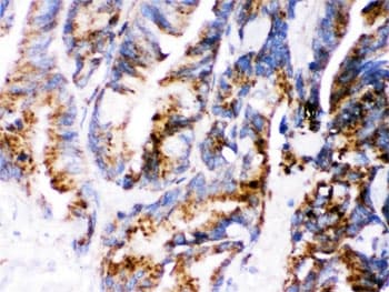 Polyclonal Rabbit anti-Human CTSD / Cathepsin D Antibody (IHC, WB)