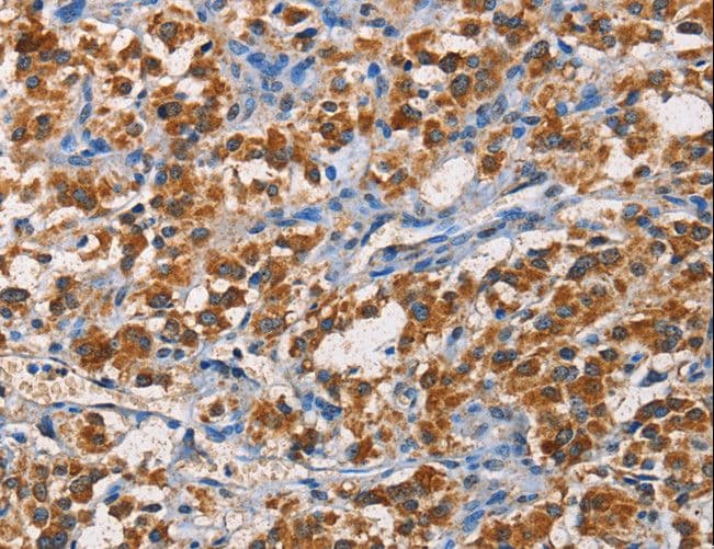 APLNR/ Apelin Receptor / APJ Antibody