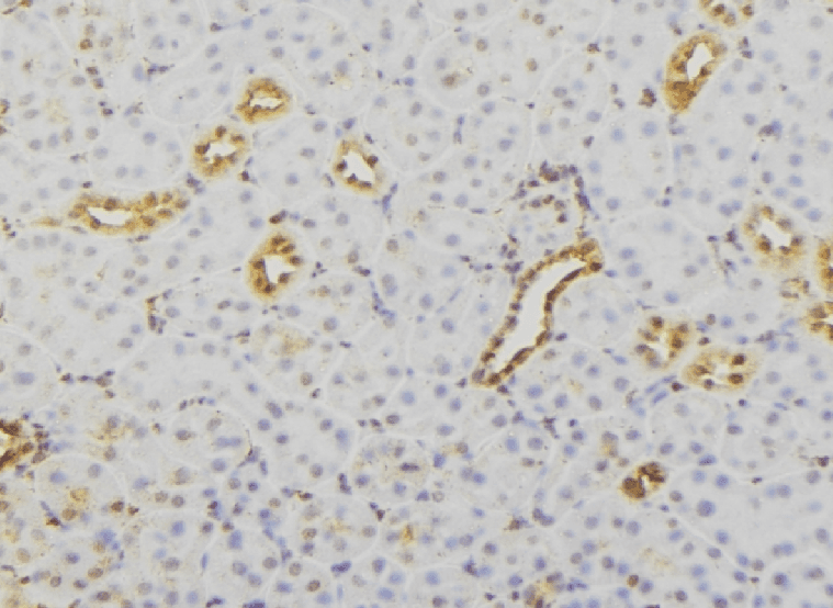 RAB23 Antibody