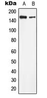 KPI-2 / LMTK2 Antibody (Internal)
