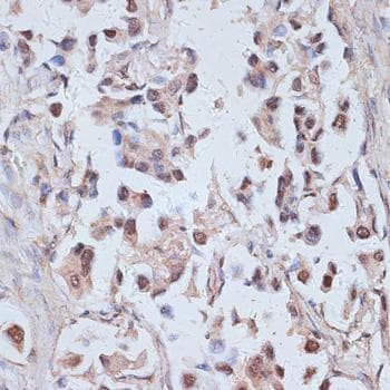 TAX1BP1 Antibody