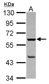 PLA2G4F Antibody (Internal)