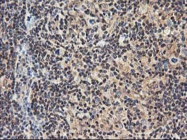 NUDT18 Antibody (clone OTI5F9)