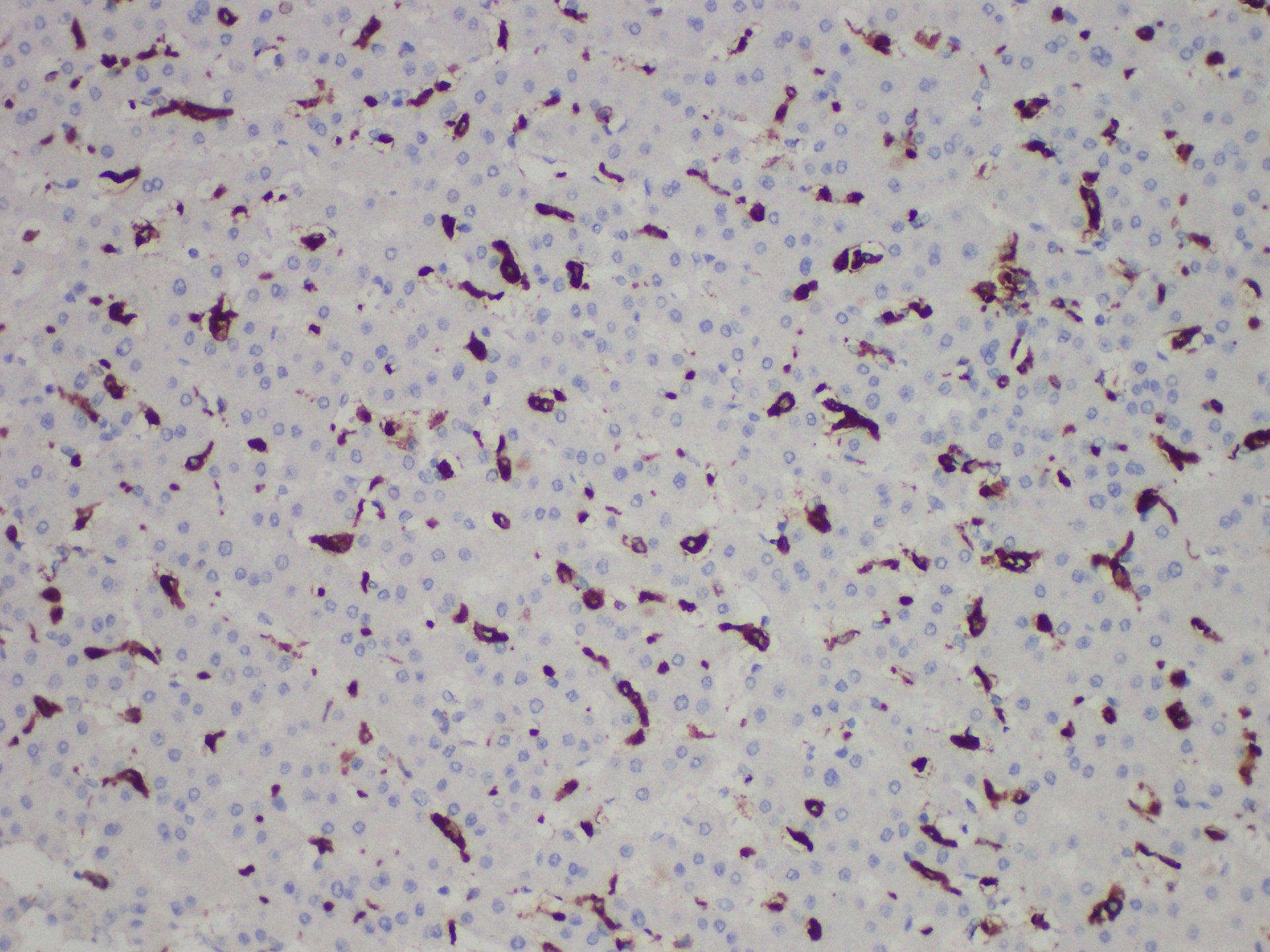 CD163 Antibody