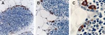 Polyclonal Rabbit anti-Human TRAF2 Antibody (aa87-106, IHC, WB)