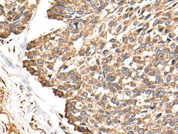 Polyclonal Rabbit anti-Human RCAN3 / Calcipressin 3 Antibody (IHC)