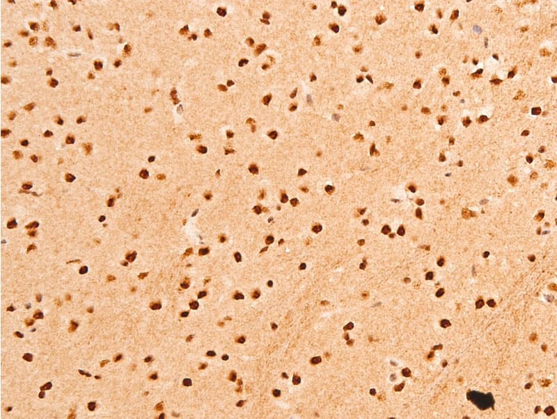 Polyclonal Rabbit anti-Human JUN / c-Jun Antibody (phospho-Thr91, IHC, WB)