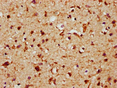FGF1 / Acidic FGF Antibody (aa16-155)