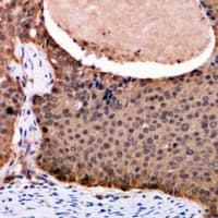 FOXO3 / FOXO3A Antibody