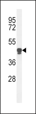 LP-PLA2 / PLA2G7 Antibody (aa200-228)
