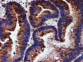 PDIA4 / ERP72 Antibody (clone OTI2C11)