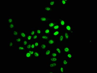 HIST1H2BN Antibody