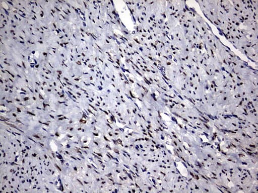 Monoclonal Mouse anti-Human PRX-1 / PRRX1 Antibody (clone OTI6A4, IHC, WB)