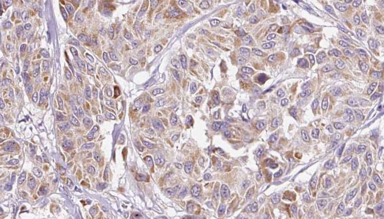 Polyclonal Rabbit anti-Human IL8 / Interleukin 8 Antibody (IHC, WB)