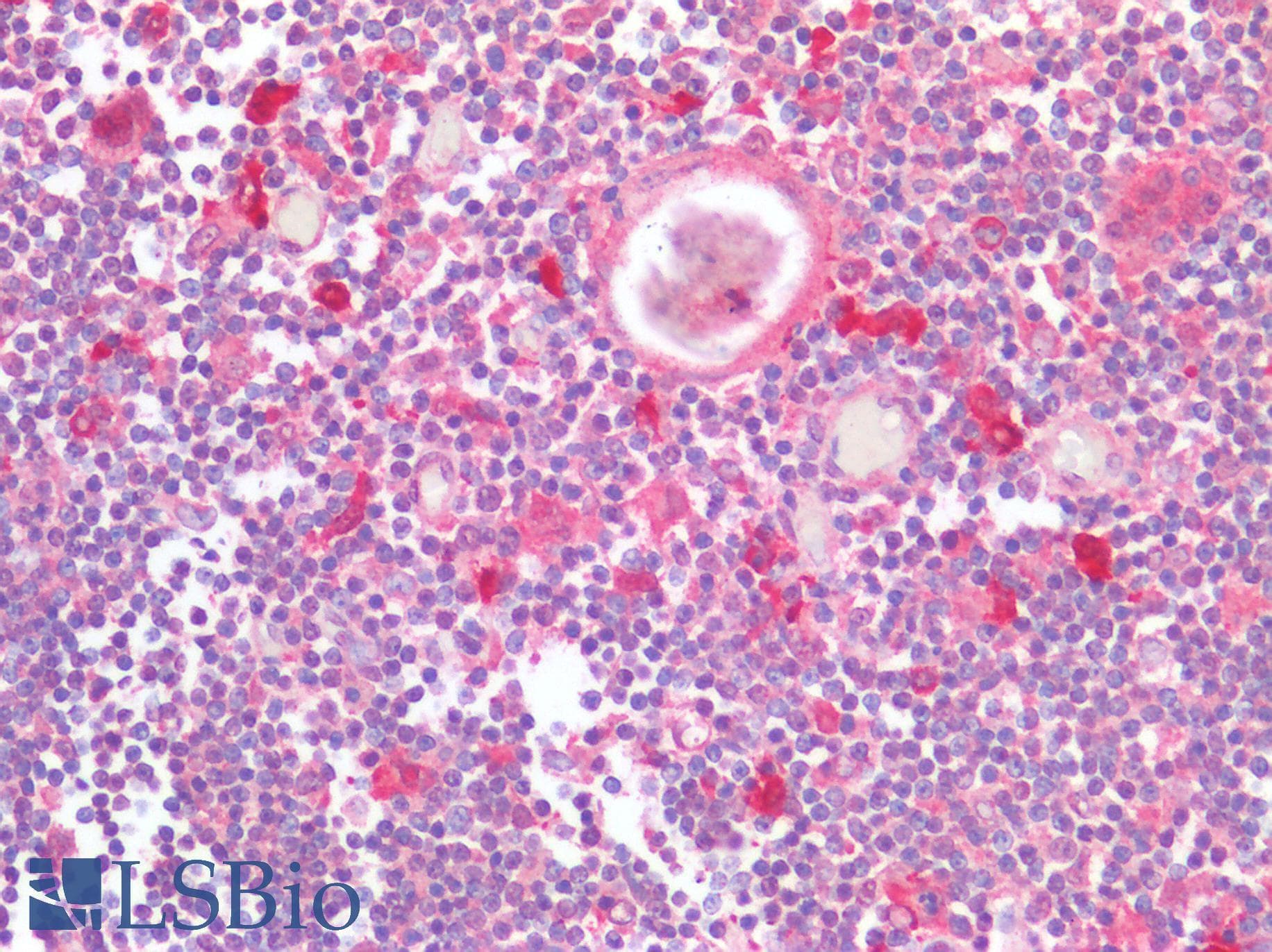 PathPlus™ CCR5 Antibody