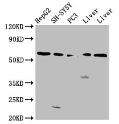 IHC-plus™ UGT1A / UGT1A1 Antibody