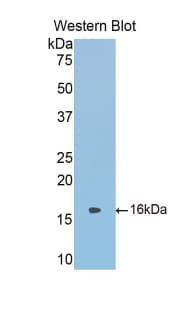 SERPINA6 / CBG Antibody (aa268-391)